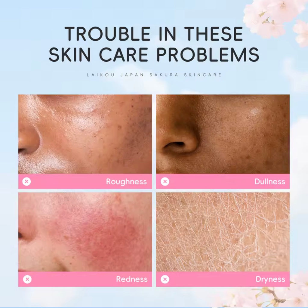 Sakura Cherry Blossom Toner – Brightens, Hydrates & Evens Skin Tone