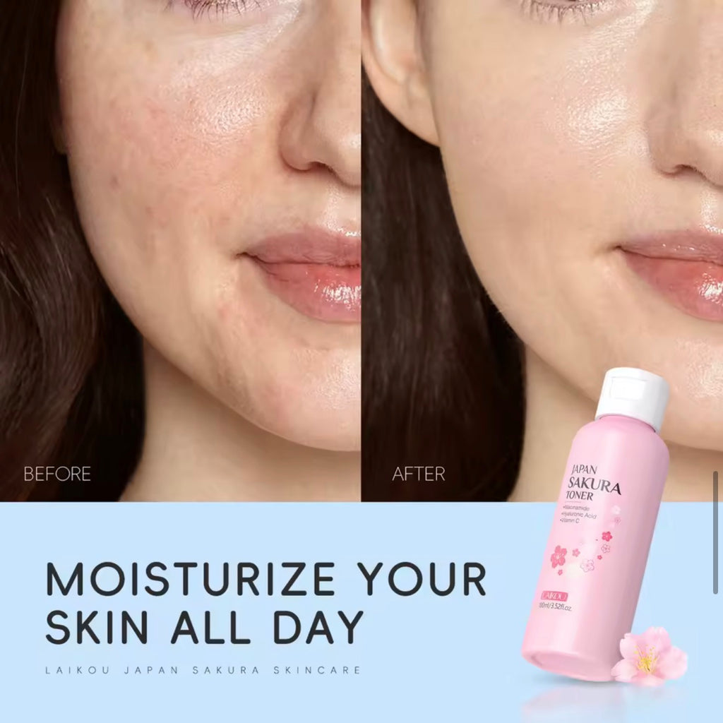 Sakura Cherry Blossom Toner – Brightens, Hydrates & Evens Skin Tone